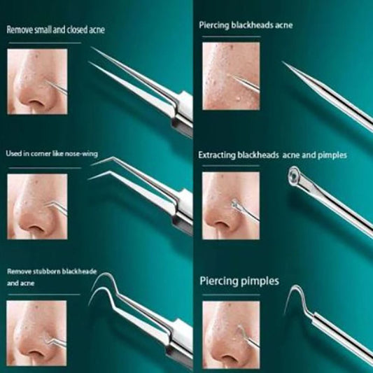 Ultra-Fine Acne Needle Set