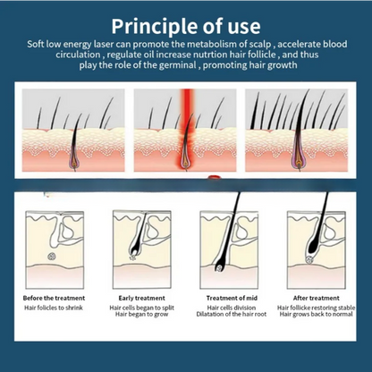 Infrared Hair Growth Cap