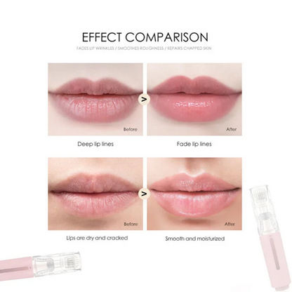 Lip Micro Needle Serum Kit