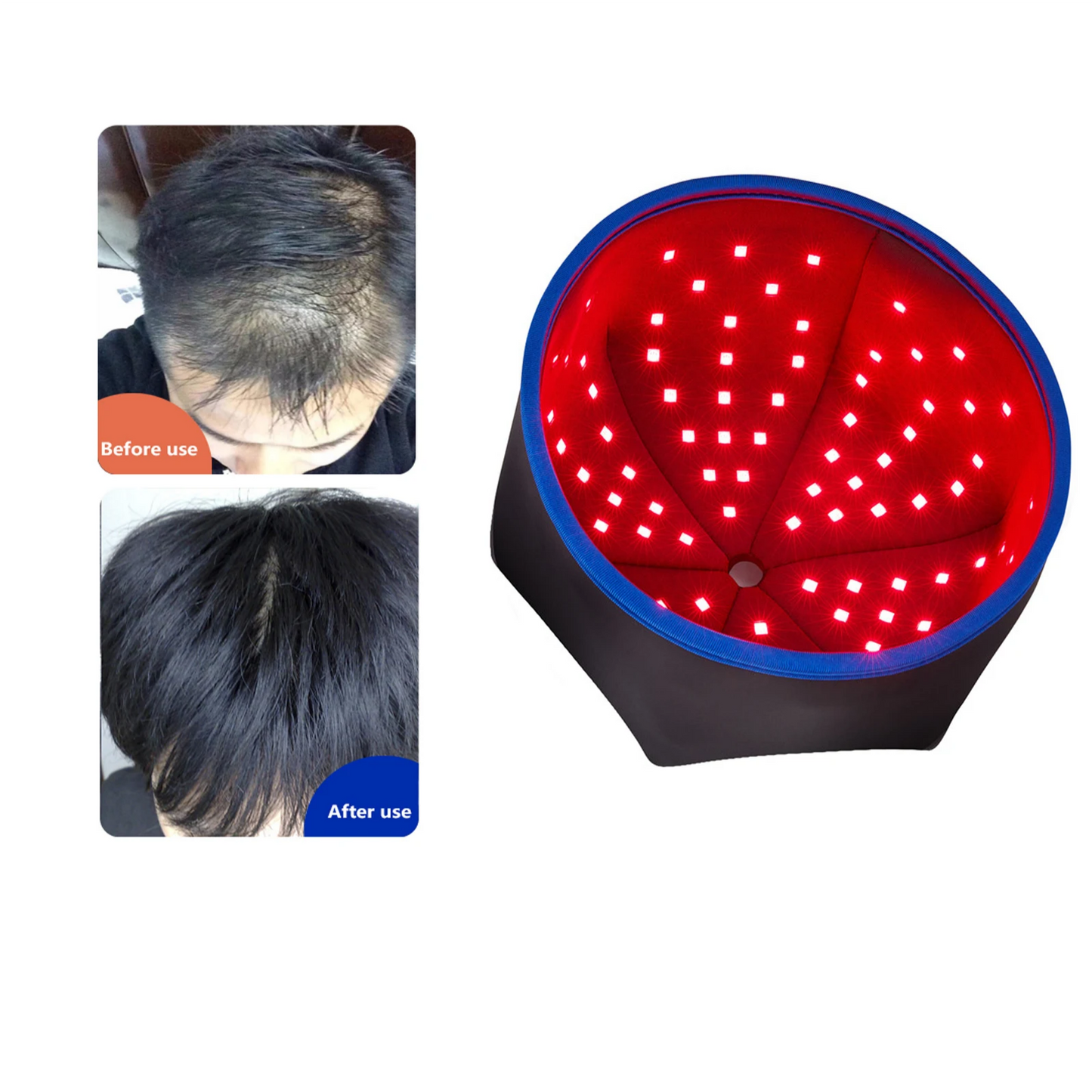 Infrared Hair Growth Cap